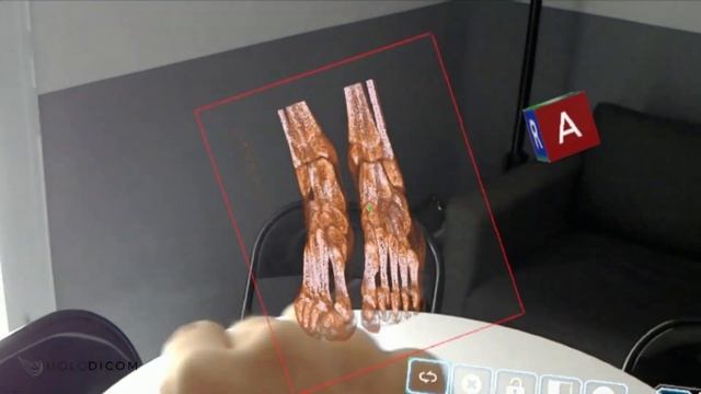 Holodicom - Visualizador de DICOM en hologramas смотреть онлайн