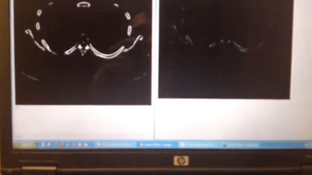 DICOM in HTML5 смотреть онлайн