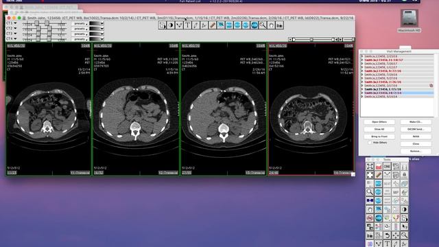 Multiframe SC DICOM part 1 смотреть онлайн