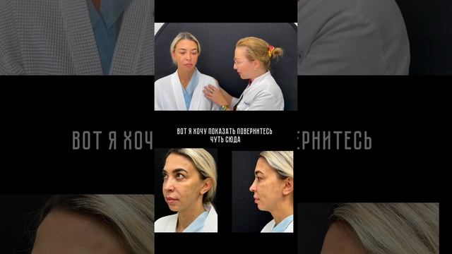 Подтяжка лица: блефаропластика, эндоскопическая подтяжка, смас пластика.