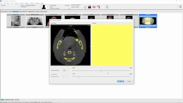 NemoBOX 05 Capture DICOM смотреть онлайн