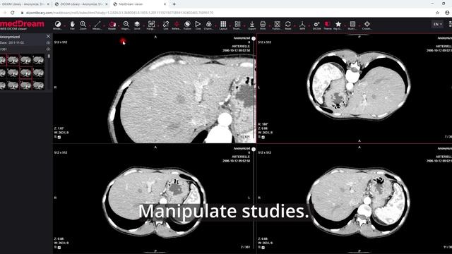 DICOM Library: upload, anonymize, view, share and download anonymized DICOM files online смотреть онлайн