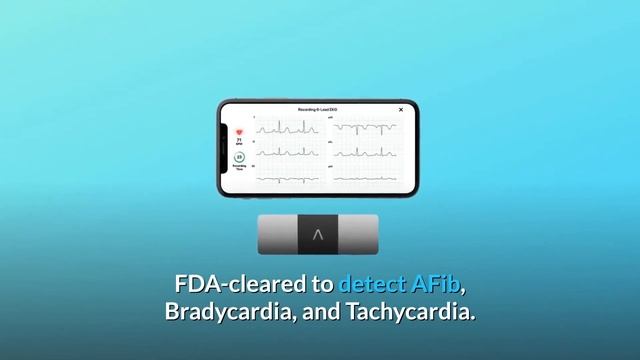 AliveCor KardiaMobile 6L | FDA-Cleared | Wireless 6-Lead EKG Review