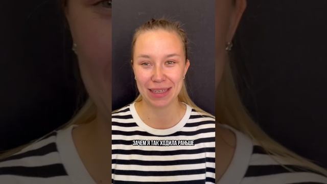 Ранний результат эндоскопической подтяжки