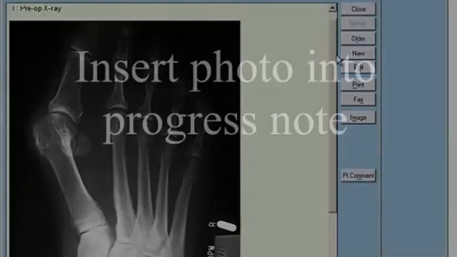 Inserting Digital Images into Practice Partner смотреть онлайн