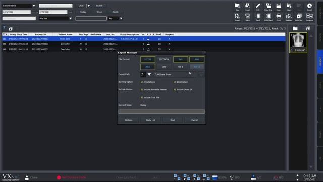 VXvue Quick Guide - Send and Export X ray Image смотреть онлайн