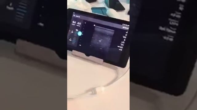 First look at Philips Lumify in my Periscope stream at RSNA 2015. смотреть онлайн