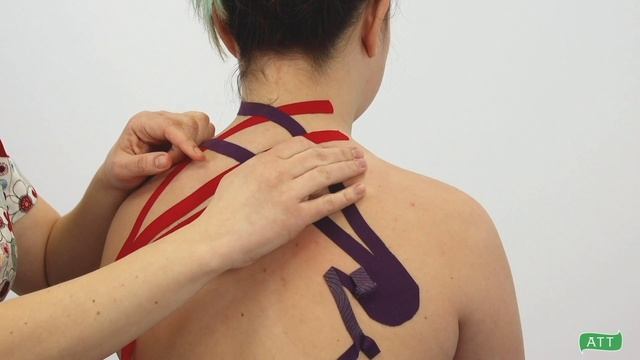 0-5_Сп-бы снятия аппликаций_ММ смотреть онлайн