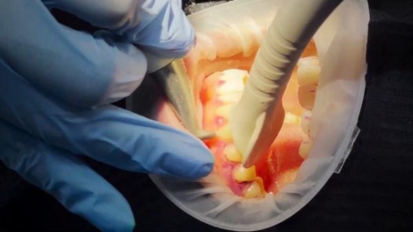 Как проходит профгигиена полости рта в DoReMi Clinic #стоматология #здоровье #профгигиена #чистка