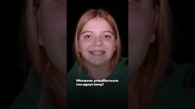 Что может произойти с улыбкой за 4 месяца лечения?😍