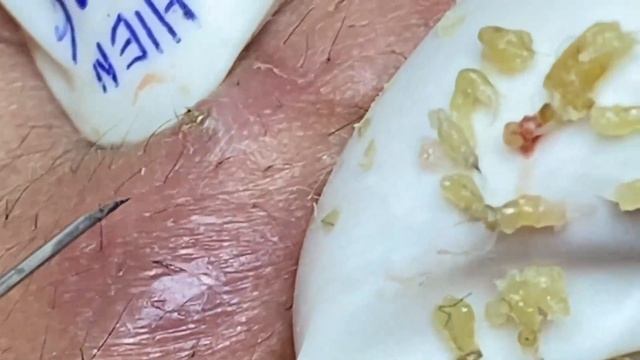 Enjoy Every Day With The Best Video Loan Nguyen Spa Official | 920 смотреть онлайн