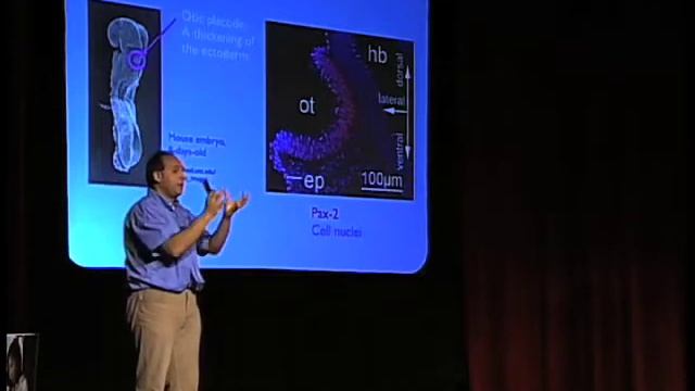 Deafness: Emerging Strategies for a Cure (Stefan Heller, Stanford University) смотреть онлайн