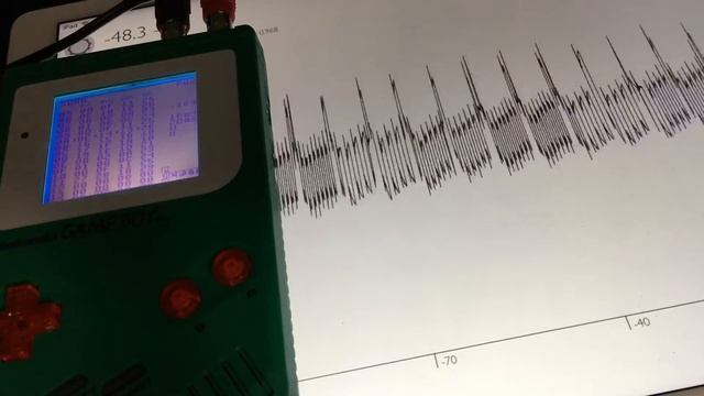 Ira Virus -- Welcome to Paradise (LSDJ Nintendo Gameboy Chiptune cover of Green Day) смотреть онлайн