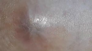 Pregnant belly button.