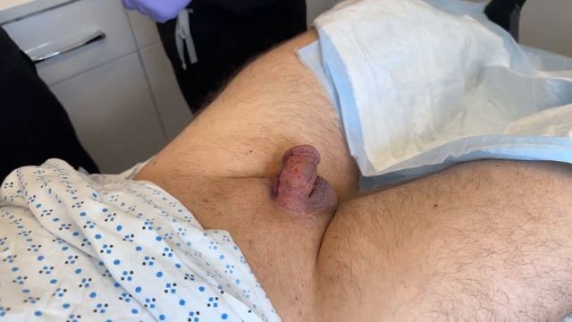 BIG DICKS IN THE BIG APPLE NEW YORK CITY WITH PENIS FILLER | INSTANT RESULTS | Dr. Jason Emer