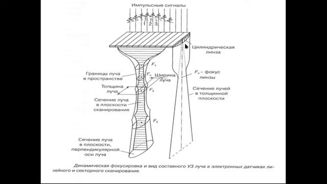 Шипуло М.Г. Артефакты ультразвукового исследования. смотреть онлайн