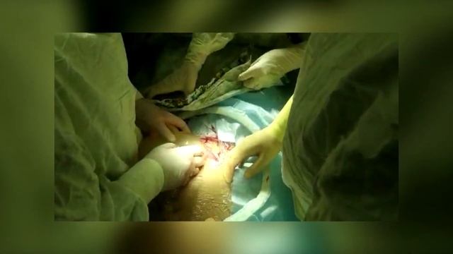 Рождение тройни смотреть онлайн