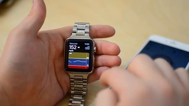 Dexcom G5 Now Works with Apple Watch & Notification Center смотреть онлайн