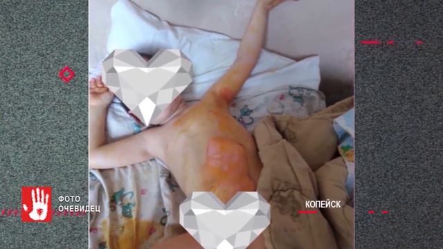 На мать четверых детей, у которой ребенок оказался с ожогами в больнице, завели дело смотреть онлайн