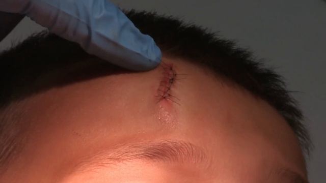 Operation Ouch - Deep Cuts & Wounds | Human Skin смотреть онлайн