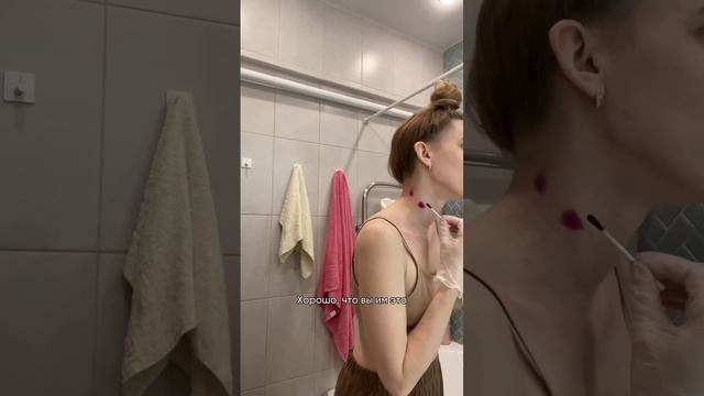 История про удаление родинок смотреть онлайн