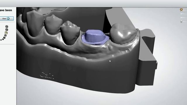 3Shape Trios Model Design from Clinical Scan September 2012 CASE SCAN IOS смотреть онлайн