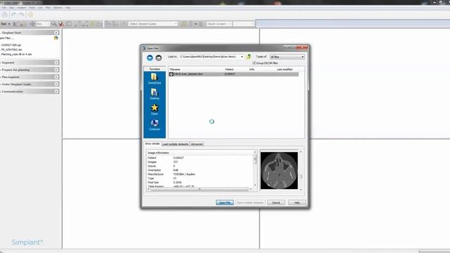 Step 1: Open raw dicom files смотреть онлайн