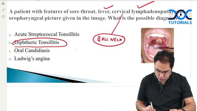 FMGE Expected Questions Series - ENT by Dr Rajiv Dhawan for FMGE Jun 22 Aspirants | DocTutorials смотреть онлайн