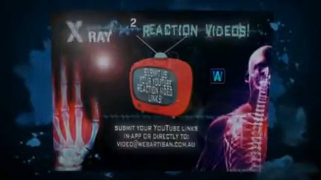 Amazing X-Ray FX ² Reaction VIdeos смотреть онлайн