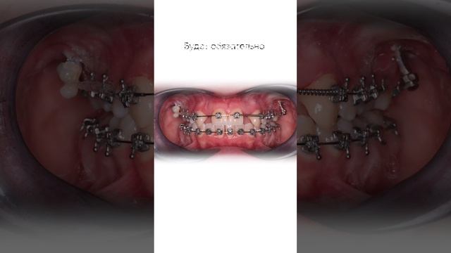 Доверяйте врачу