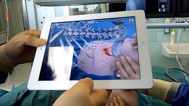 Surgery Pad - mobile medical augmented reality App for the Apple iPad смотреть онлайн