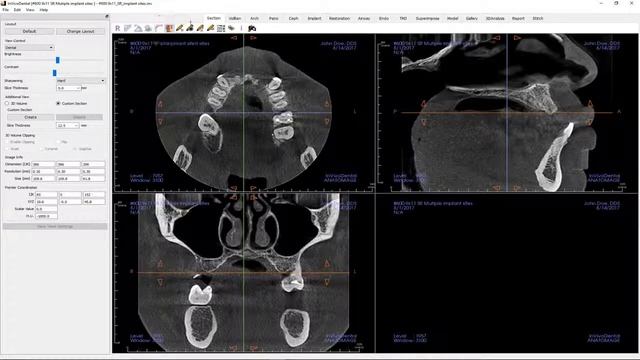 Invivo™ 6 Tutorial - Section View - Getting Started, Part 1 смотреть онлайн
