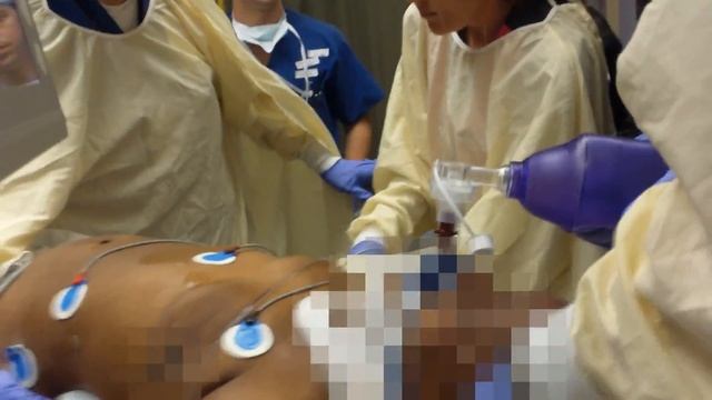 Removing the King LT Airway Device смотреть онлайн