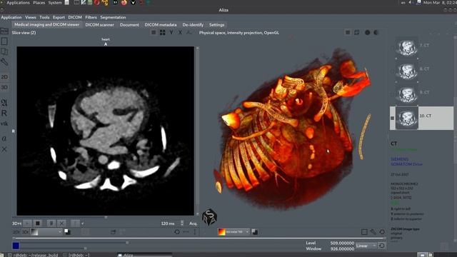 Aliza / Aliza MS DICOM Viewer. 3D+t Cardio. смотреть онлайн