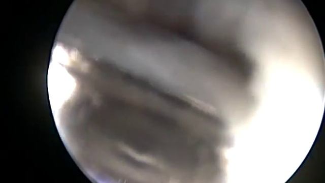 Equine Arthroscopy on Telepack Vet X смотреть онлайн