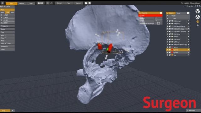 PME Planner - Flanged acetabular cup with augment смотреть онлайн