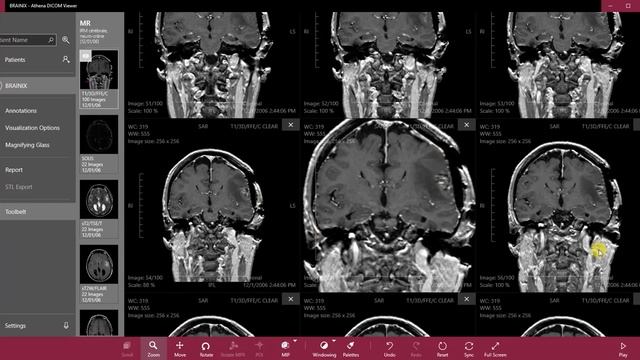 Mosaic - Athena DICOM Viewer смотреть онлайн