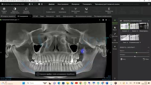 ПО для работы с 2D и 3D снимками DTX Dental Studio смотреть онлайн