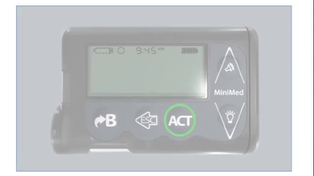 How to Insert the MiniMed Quick-set Infusion Set: Rewinding the Pump (Part 1 of 4) смотреть онлайн