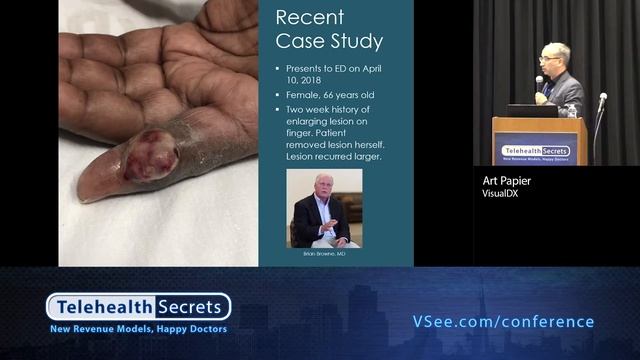 Diagnostic Errors, Decision Support and the Telemedicine Workflow - Art Papier, MD (VisualDX) смотреть онлайн