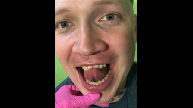 Постановка звука "Р" смотреть онлайн