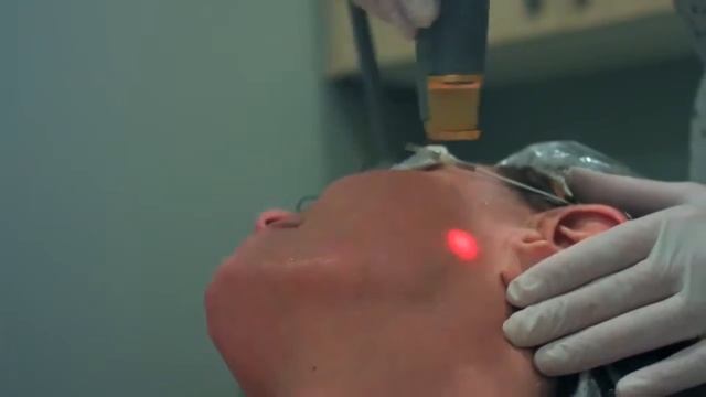 Laser Genesis Cutera XEO смотреть онлайн