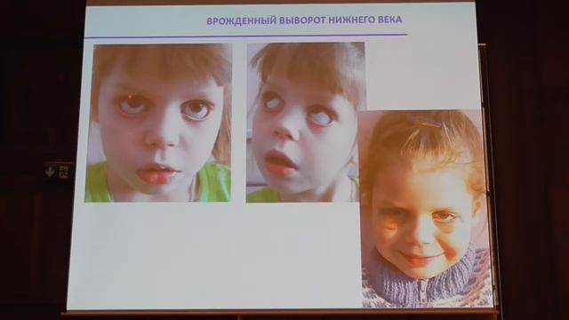 Синдром «сухого глаза» актуальность проблемы в различном возрасте смотреть онлайн
