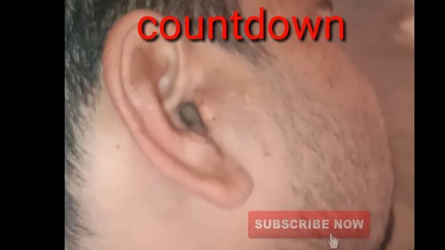 How to remove insects to ear at home ! insects removed to ear смотреть онлайн