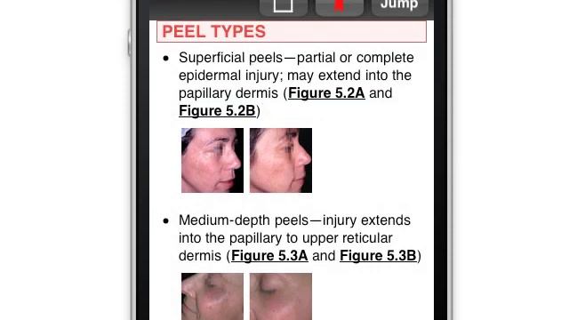 Color Atlas of Cosmetic Dermatology - iPhone / iPad app demo by Usatine Media смотреть онлайн