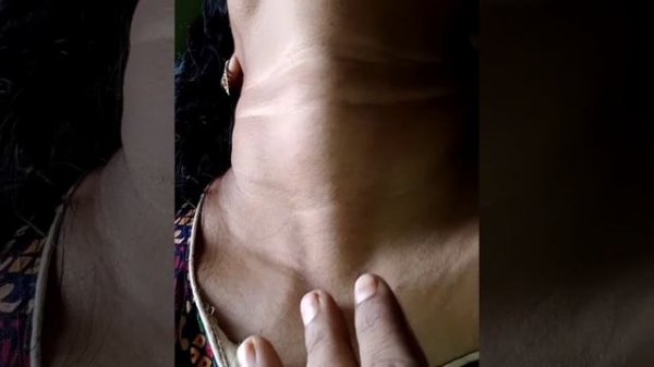 Neck Adam's Apple Lovely Sound And Vety Hot Neck Moment🥰😘