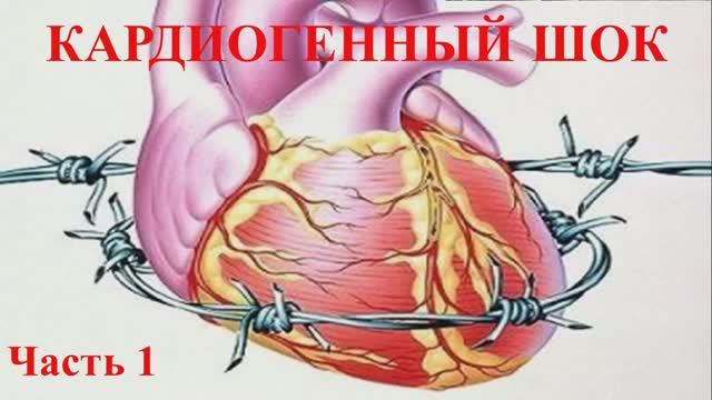 Кардиогенный Шок_ часть первая смотреть онлайн