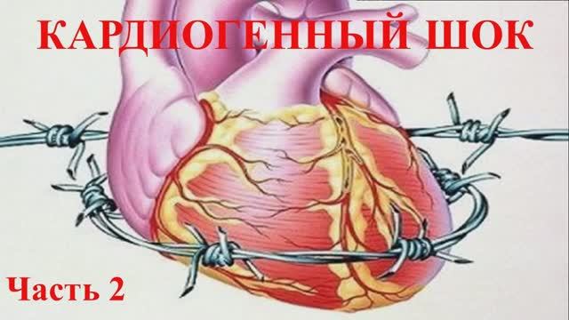 Кардиогенный шок. Часть вторая смотреть онлайн
