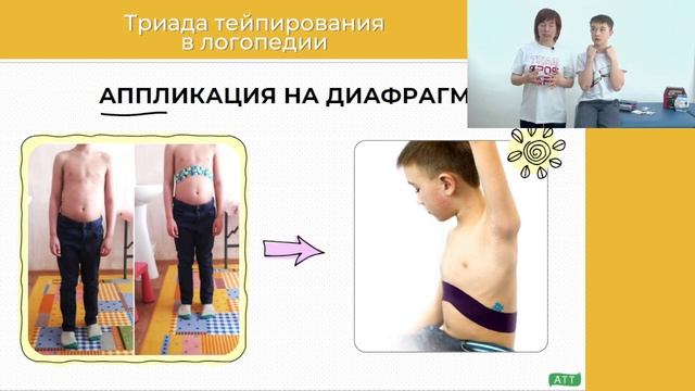 Как_включить тейпирование вработу_логопеда. Триада тейпирования. смотреть онлайн