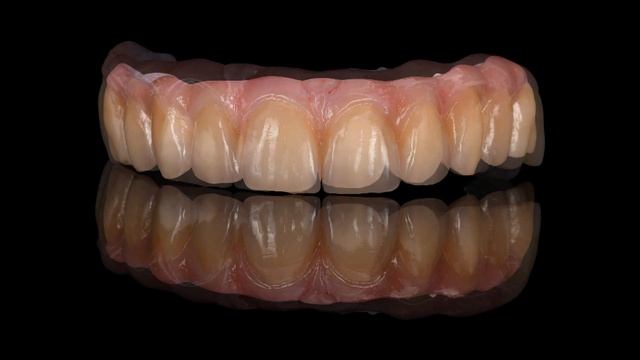 "All-on-four" Prettau® Bridge | Zirkonzahn.Galleries смотреть онлайн